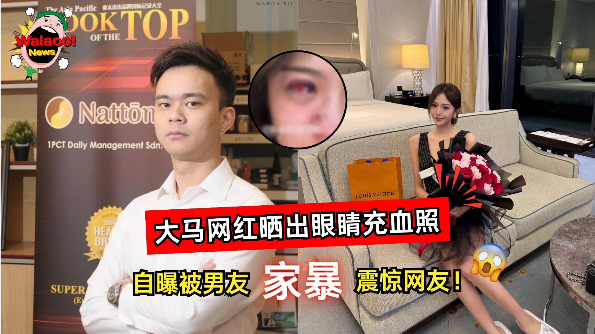 Jolyn被家暴 （News Cover）