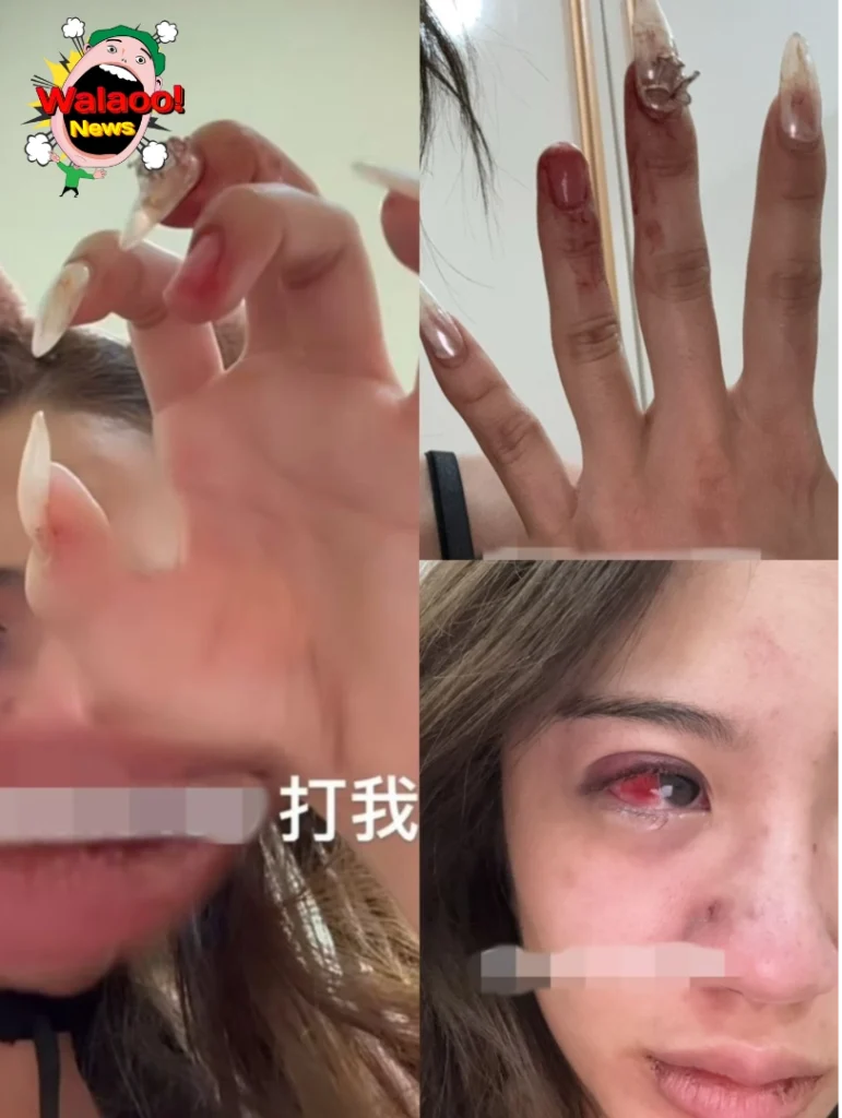 Jolyn被家暴（图1）