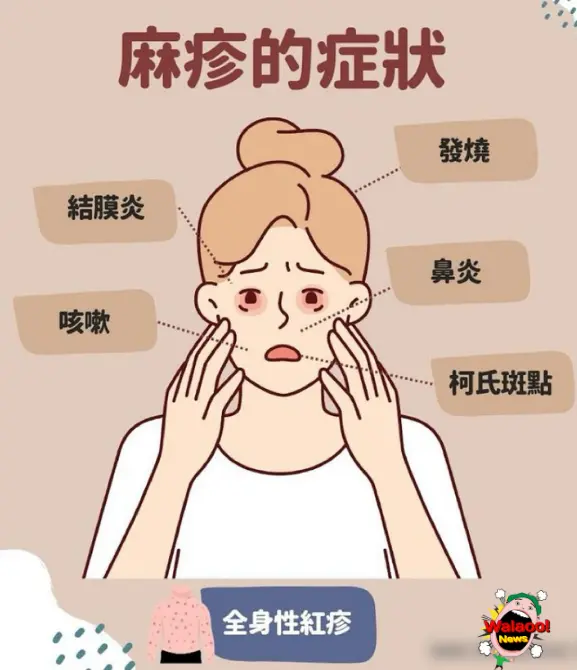 麻疹症状图示包含发烧、咳嗽、鼻炎和柯氏斑点等